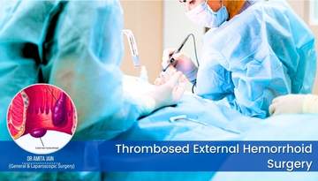 Dr Amita Jain is the best Thrombosed External Hemorrhoid Surgeon